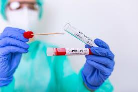 Piemonte: sarà possibile prenotare test sierologico o tampone per COVID 19  in Farmacia